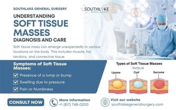 Are all soft tissue masses cancerous?