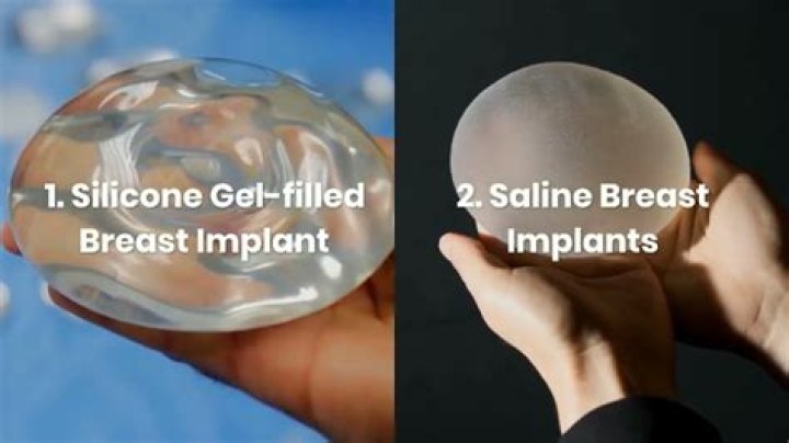 Are breast implants out of style?