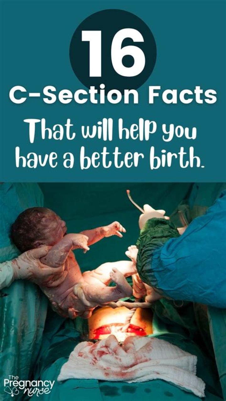 Are C-sections worse than natural birth?