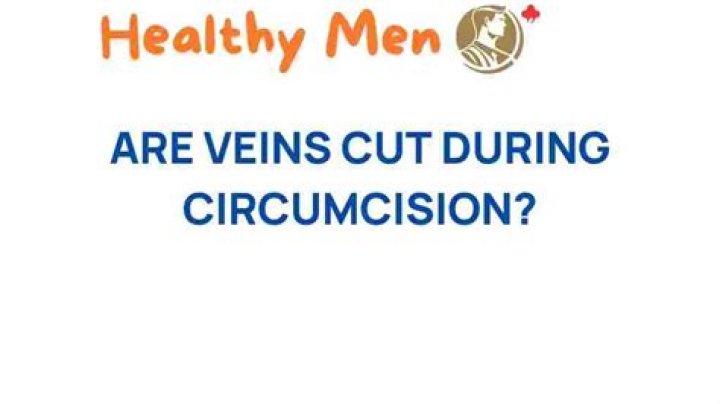 Are veins cut during circumcision?
