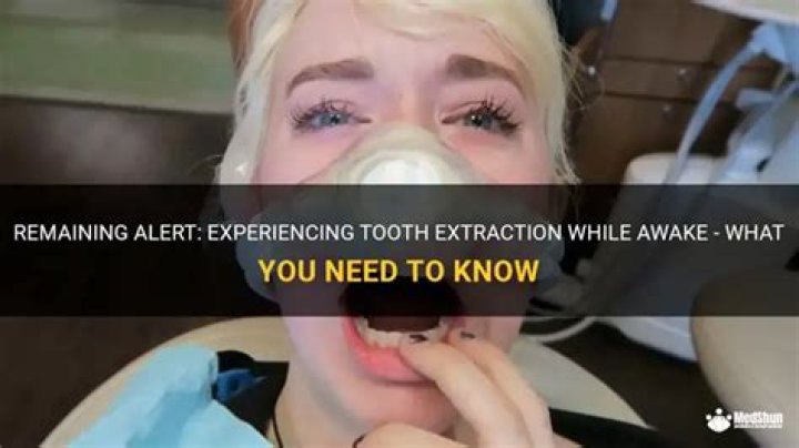Are you awake for tooth extraction?