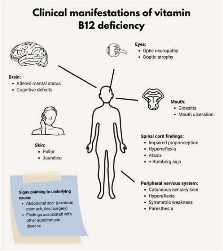 Can B12 deficiency cause Parkinson's?