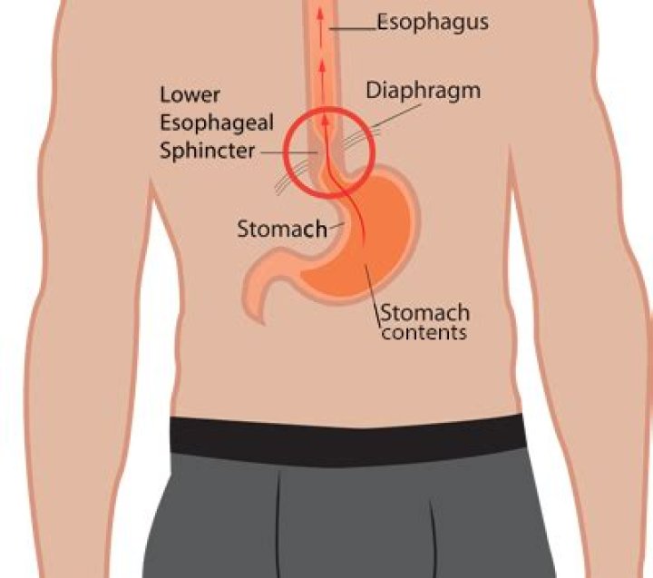 Can bad breath come from the stomach?