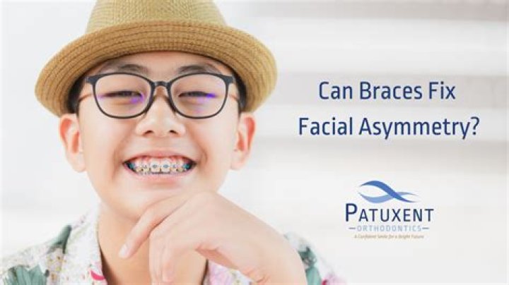 Can braces fix small jaw?