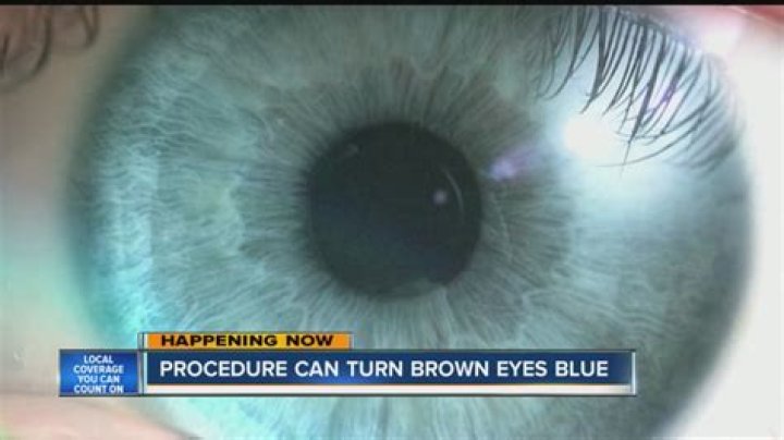 Can brown eyes turn blue naturally?
