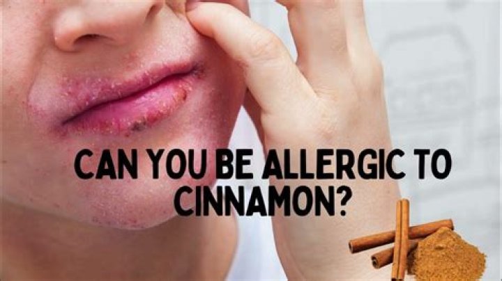 Can cinnamon damage your skin?