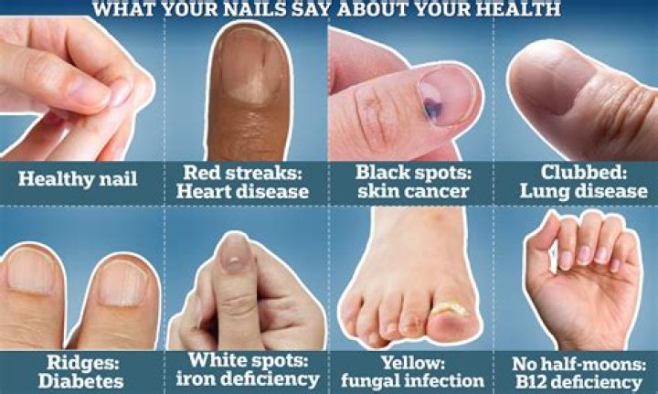 Can diabetes affect toenails?