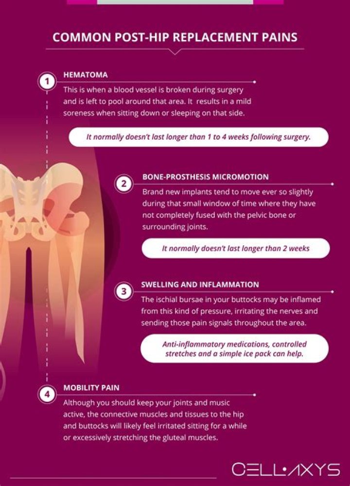 Can diverticulitis cause hip and back pain?