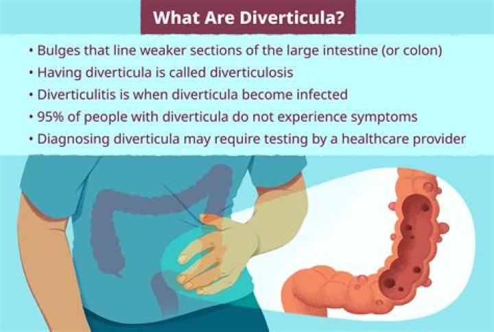 Can diverticulitis cause tachycardia?