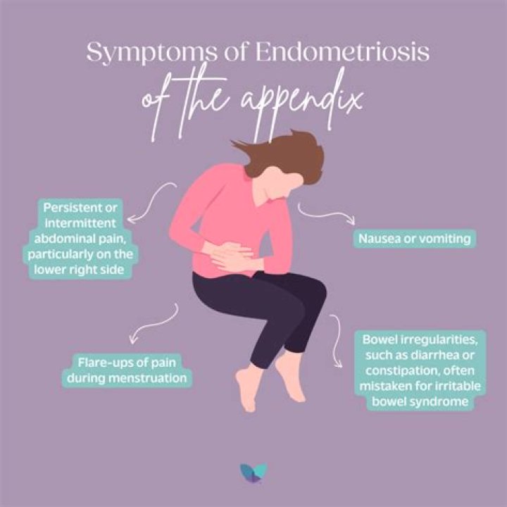 Can endometriosis cause flu like symptoms?