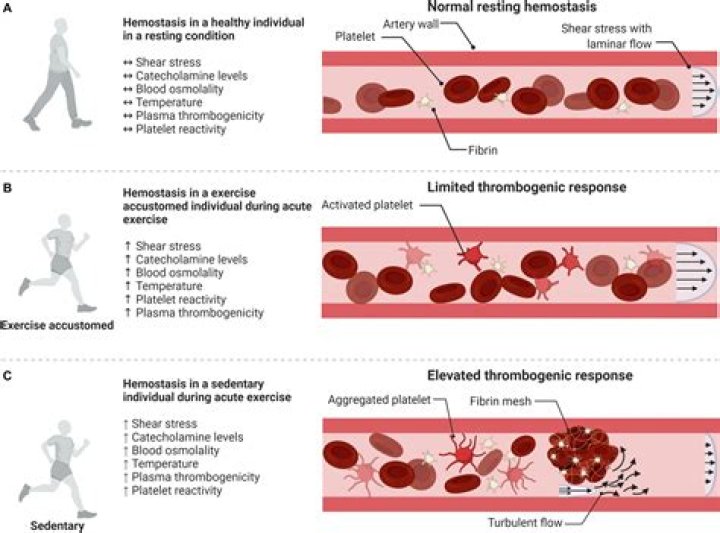 Can Exercise dissolve blood clot?