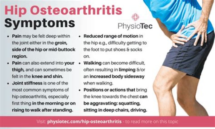 Can hip arthritis mimic sciatica?