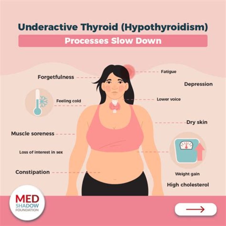 Can hypothyroidism cause weakness in legs?