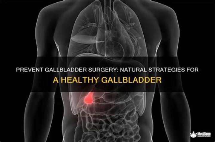 Can I avoid gallbladder surgery?
