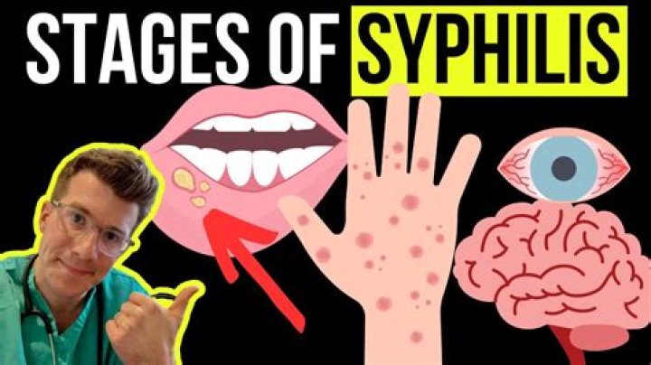 Can I get syphilis from saliva?