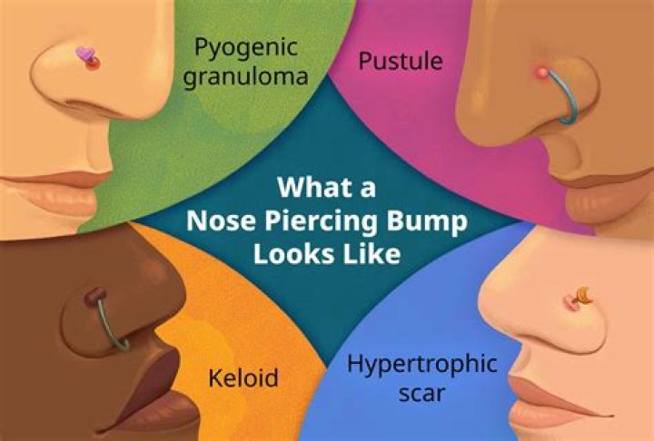 Can I pierce my nose while pregnant?
