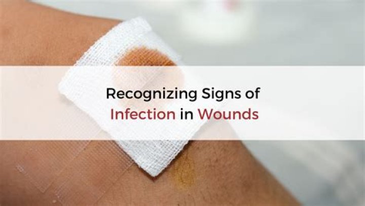 Can I shower with infected wound?
