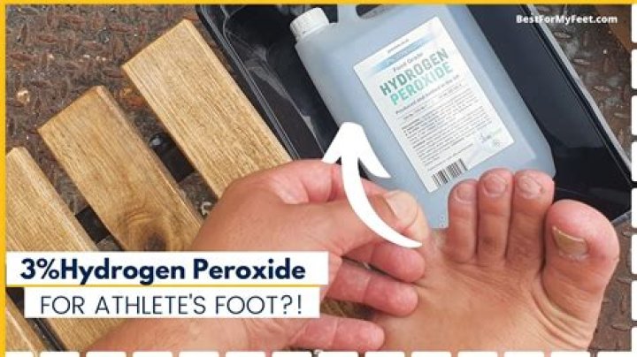 Can I soak my feet in hydrogen peroxide?