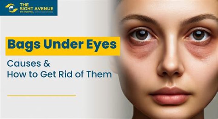 Can liver problems cause eye bags?