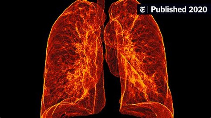 Can lungs repair themselves?