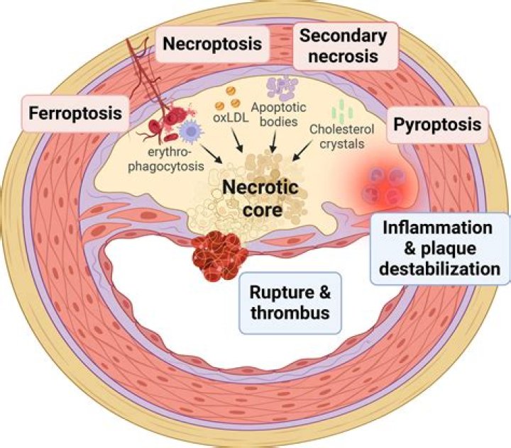 Can necrotic tissue be reversed?