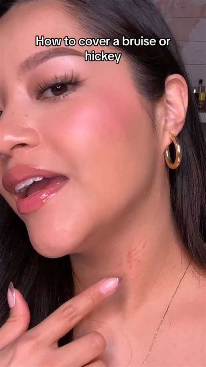 Can red lipstick cover hickeys?