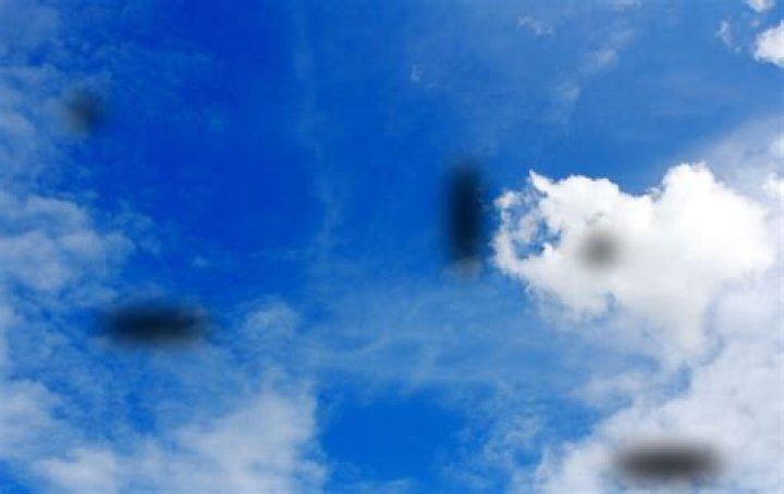 Can stress cause eye floaters?