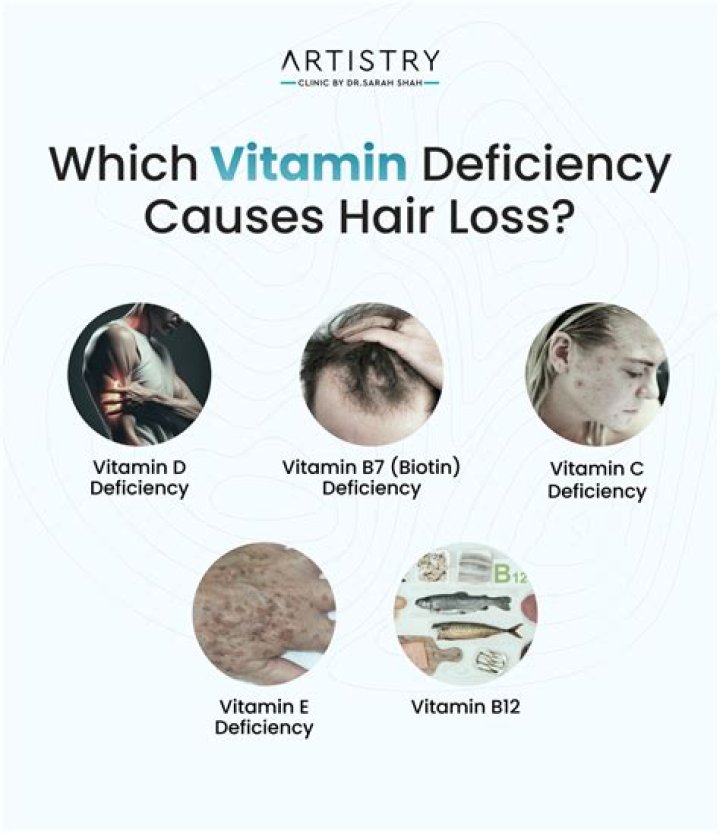 Can too much Vit D cause hair loss?