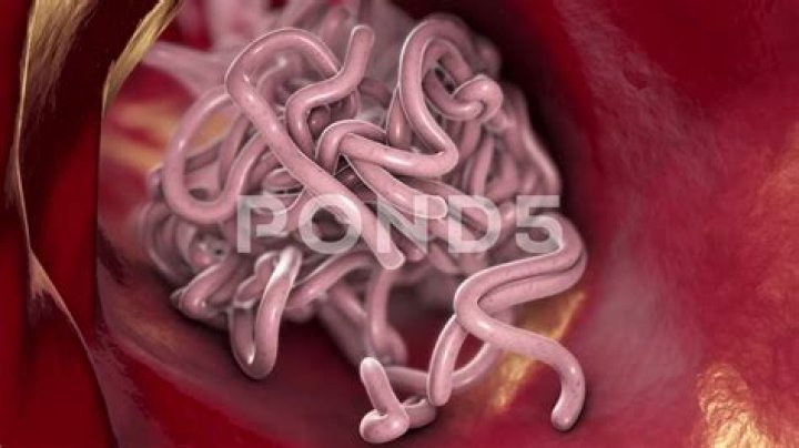 Can worms come out of your skin?