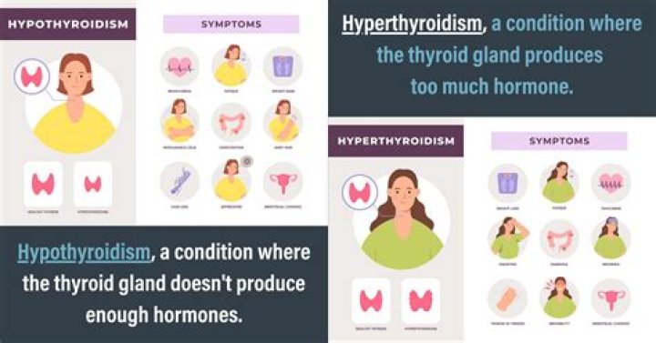 Can you be skinny and have hypothyroidism?
