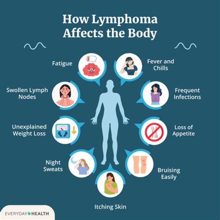 Can you feel fine with lymphoma?