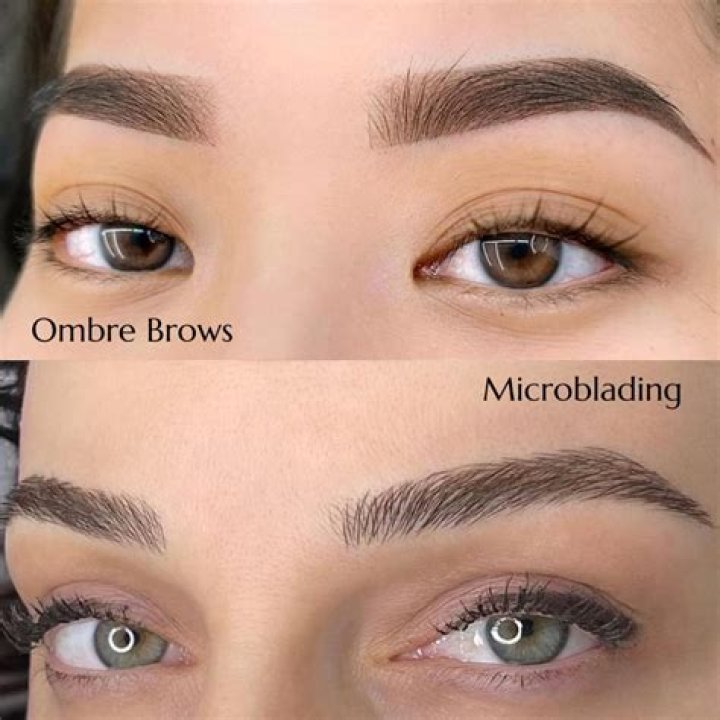 Can you get Microblading If you have vitiligo?