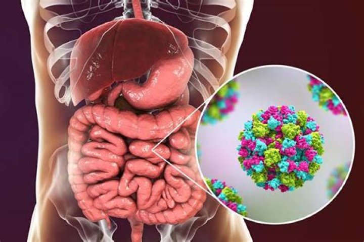 Can you get norovirus twice?