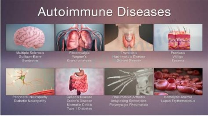Can you have 2 different autoimmune diseases?
