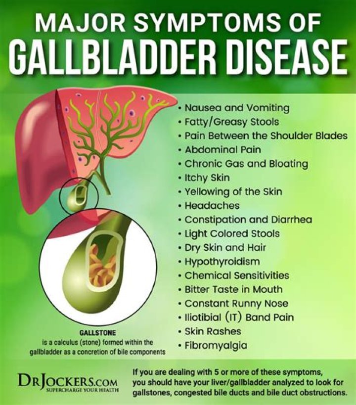 Can you have gallbladder problems without fever?