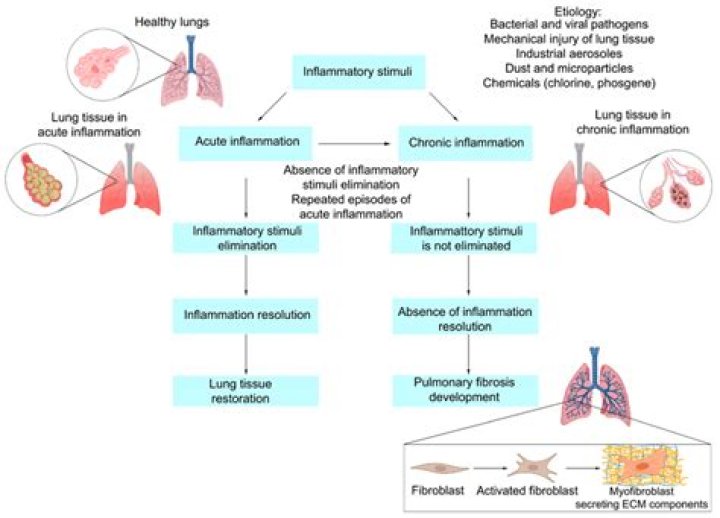 Can you live with mild pulmonary fibrosis?
