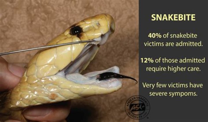 Can you survive king cobra bite?