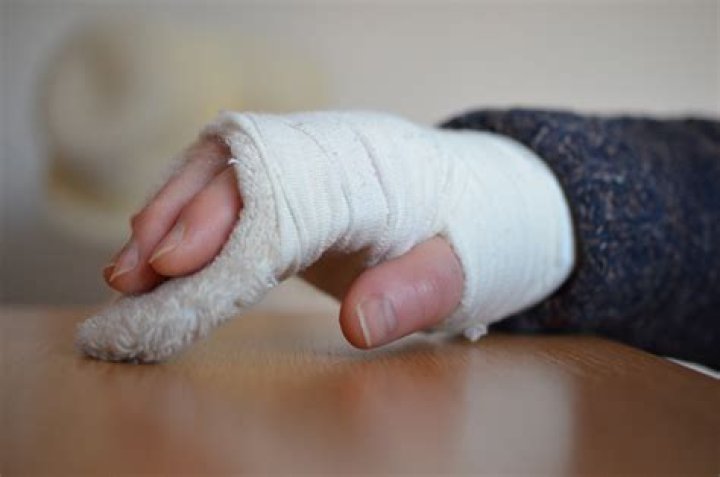 Can you swim with a broken hand?
