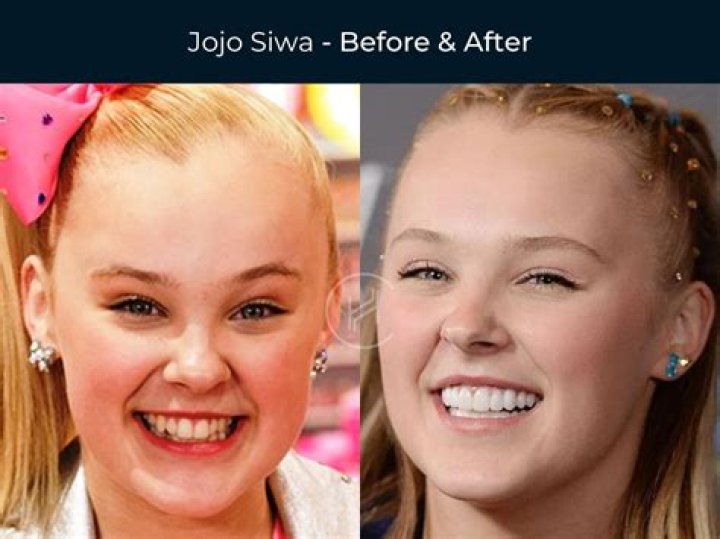 Did Meghan Trainor adopt JoJo Siwa?