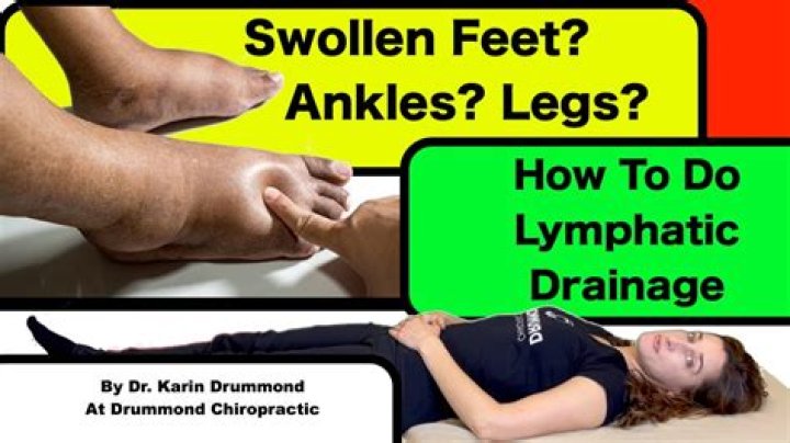 Do bananas help swollen feet?