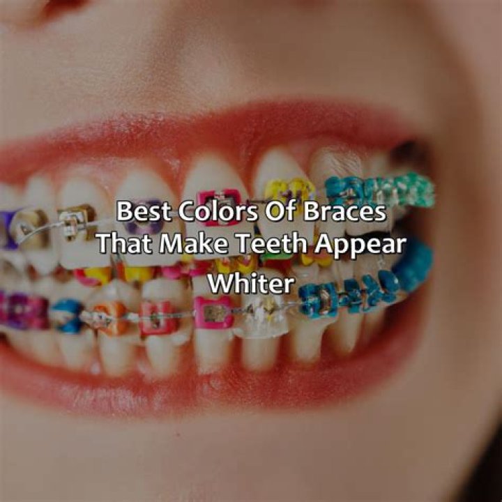 Do black braces make your teeth look yellow?