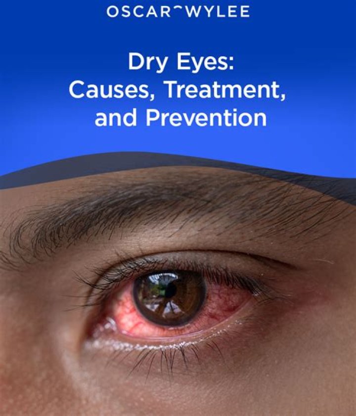 Do hot showers cause dry eyes?