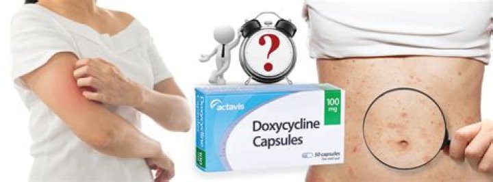 Do I have to take doxycycline at the same time every day?
