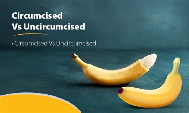 Do Japanese circumcise?