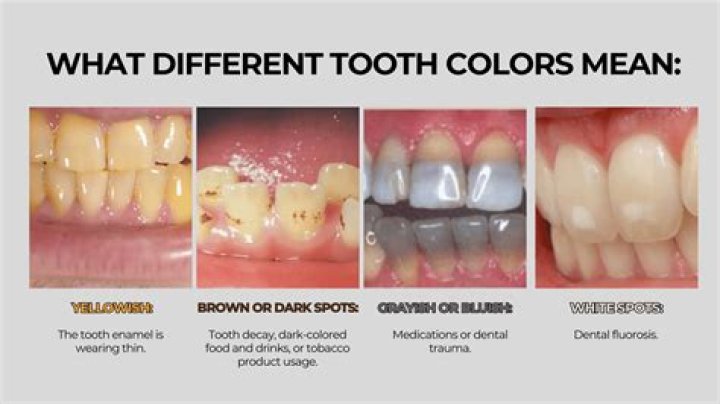 Do lemons make your teeth yellow?