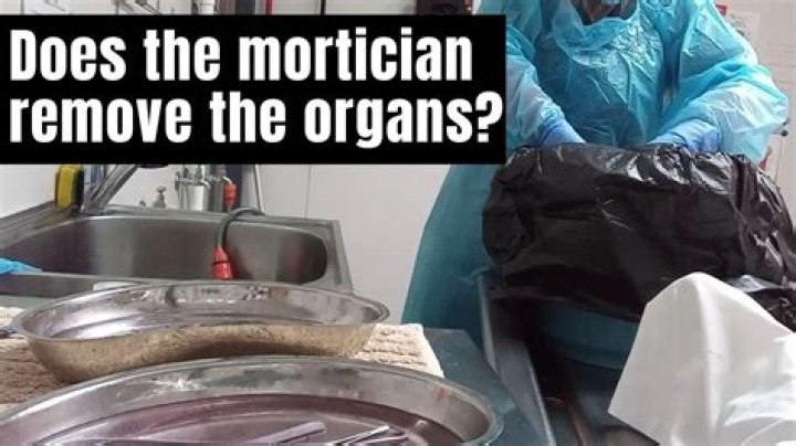 Do morticians sew mouths shut?