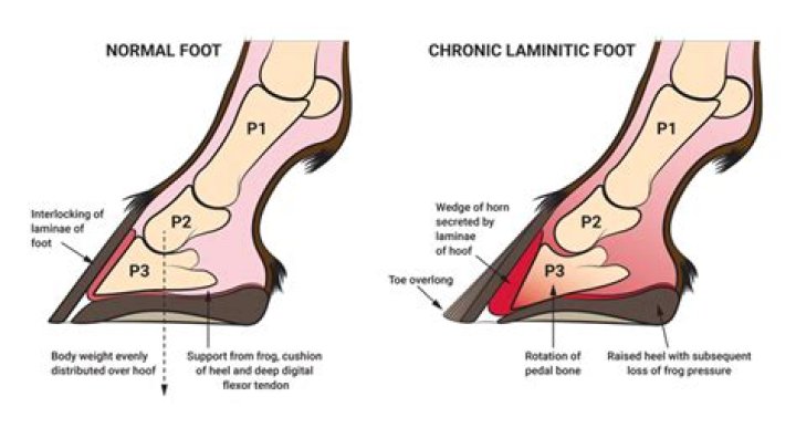 Do shoes help laminitis?