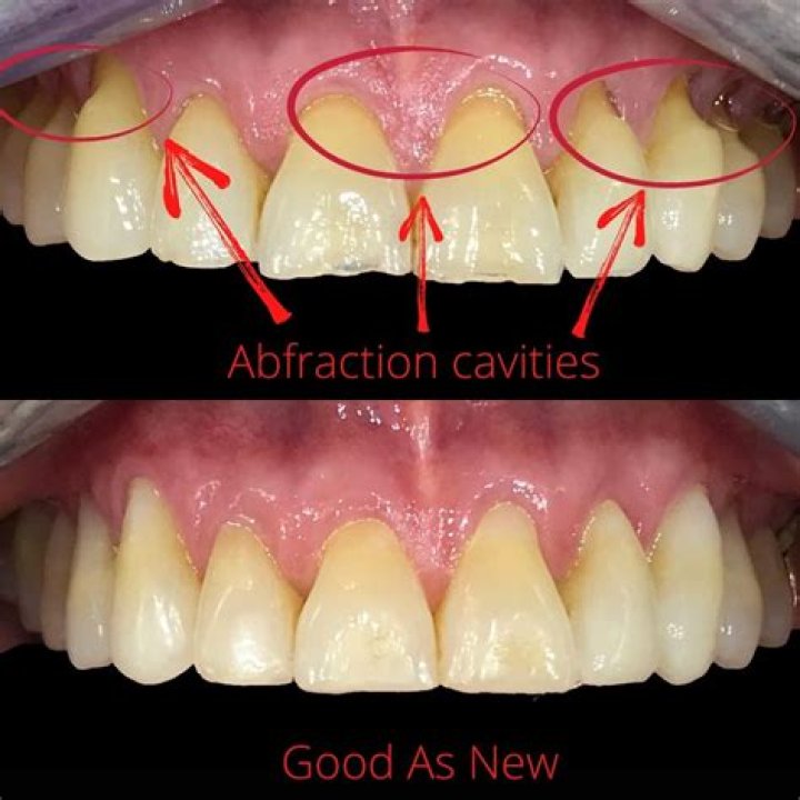 Do teeth become more sensitive as you age?