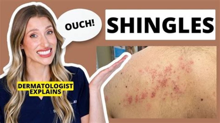 Do they make 15 year shingles?