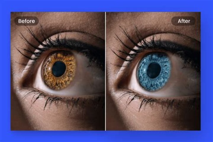 Do twins have same color eyes?